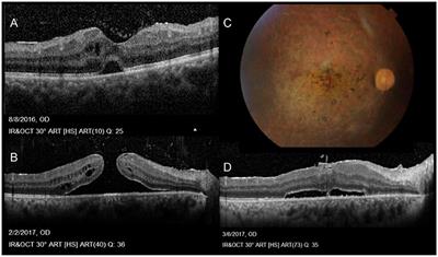 Behçet uveitis: Current practice and future perspectives